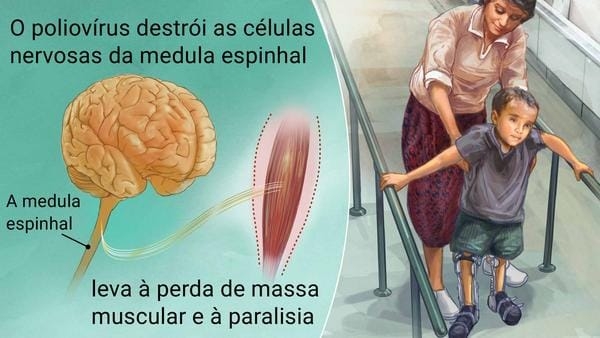 VACINAÇÃO: CAMPANHA DE VACINAÇÃO CONTRA POLIOMIELITE E MULTIVACINAÇÃO VAI ATÉ 9 DE SETEMBRO VACINAÇÃO: CAMPANHA DE VACINAÇÃO CONTRA POLIOMIELITE E MULTIVACINAÇÃO VAI ATÉ 9 DE SETEMBRO